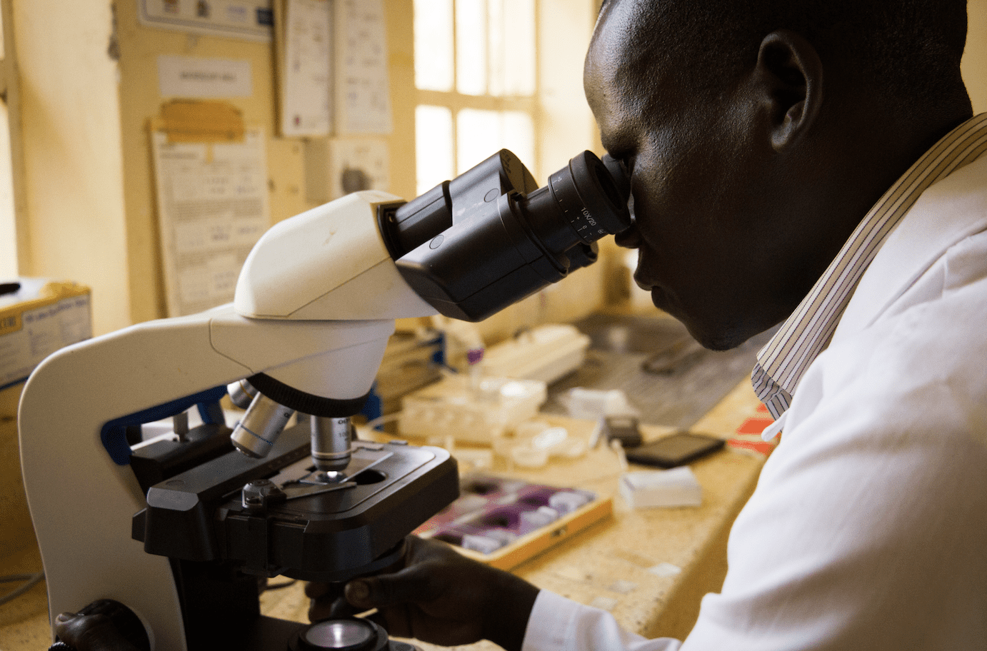 A laboratory technician at Namasale Health Centre III examines slides for TB diagnosis. 